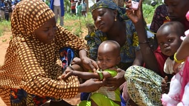 AU NIGER, LES MÈRES AU COEUR DU COMBAT CONTRE LA MALNUTRITION 5 Au Niger, les mères utilisent un périmètre brachial (PB), un brassard tricolore, qui sert à mesurer l'épaisseur du bras et détecter la malnutrition, dans le village de Barago (sud), le 14 juillet 2016 | AFP | BOUREIMA HAMA