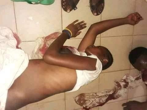 une jeune fille blessé à Coyah