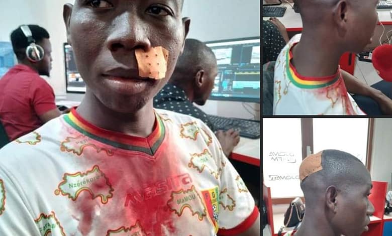 Alsény Aye Soumah, journaliste reporter au groupe Djoma médias, victime d'une agression alors qu'il couvrait les manifestations à Bambéto 3 Alseny Soumah djoma fm